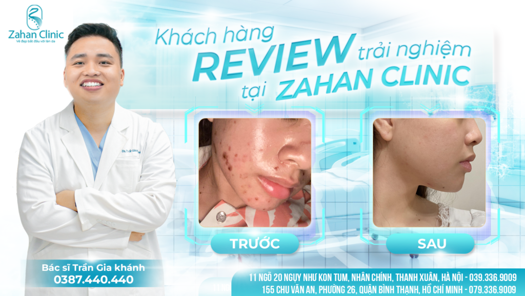 Khách hàng review trải nghiệm tại Zahan Clinic