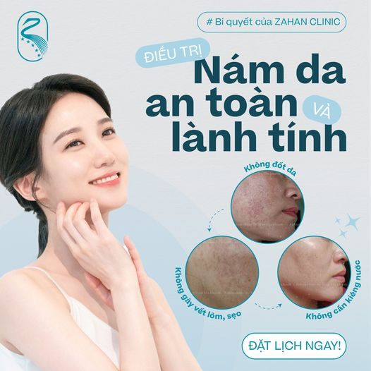 cách trị nám da an toàn lành tính