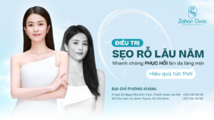 điều trị sẹo rỗ lâu năm